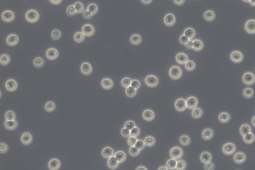Bakkergist (Saccharomyces cerevisiae) onder de microscoop Bakkergist (Saccharomyces cerevisiae) onder de microscoop